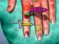 Permainan Doktor Kulit Tangan talian