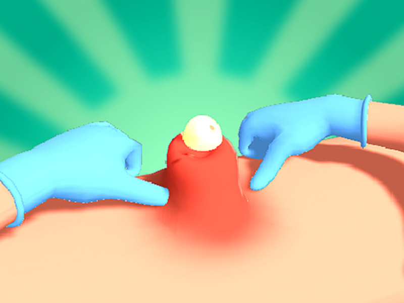Permainan Pimple memerah talian
